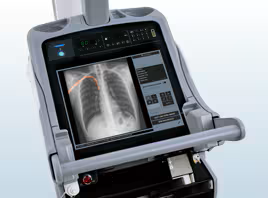 Processed image by Smart Tube